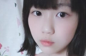 378[15v/161M/度盘]